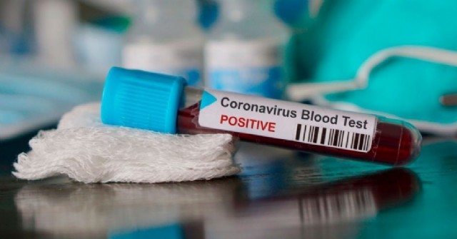 Primer caso positivo de coronavirus en Pergamino