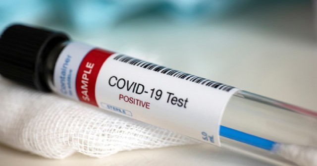 Nuevas cifras: 3 casos positivos en Salto de coronavirus