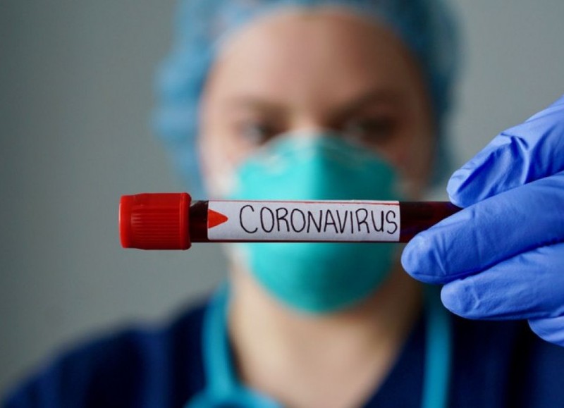 Aclararon que se han registrado 18 nuevos casos de Covid-19, por lo que los contagios siguen creciendo.