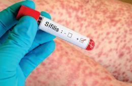 Los casos de sífilis siguen en aumento